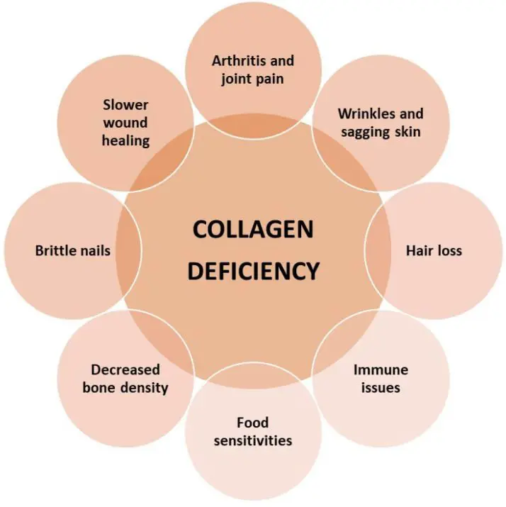 Les effets de la perte de collagène sur le corps