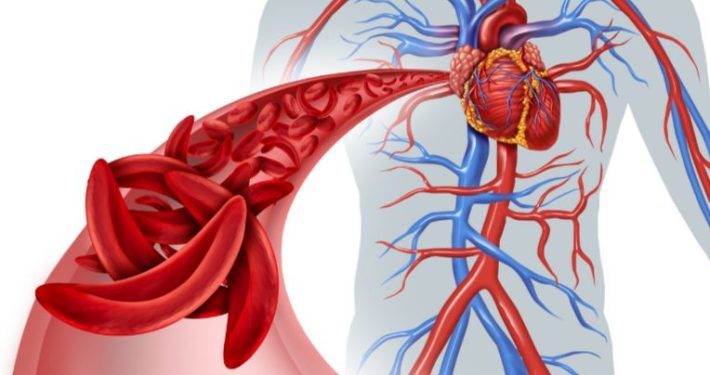 Le fer pour quoi pour qui