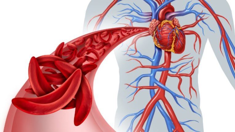 Le fer pour quoi pour qui